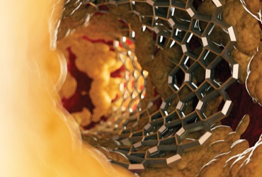 Perioperative Management of Patients With Coronary Stents